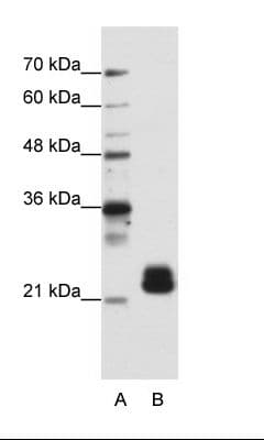 Polyclonal Rabbit anti-Human HNLF / TMED4 Antibody (N-Terminus, IHC, WB)