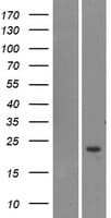 TOMM20L Protein (Over-Expression Lysate Myc-DDK (Flag))
