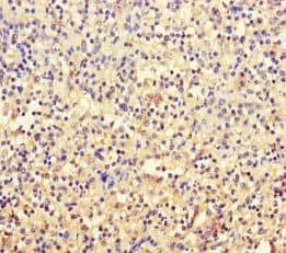 Polyclonal Rabbit anti-Human TSPAN7 / CD231 Antibody (WB)