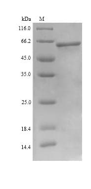 Human UAP1 Protein (Recombinant 6His, N-terminus)