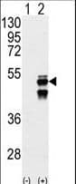 PPM1F Antibody (aa11-40)
