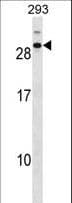 CDCA4 Antibody (aa163-190)