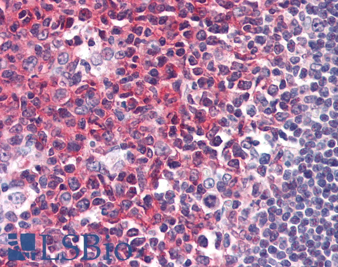 IHC-plus™ PAG1 Antibody (aa97-432, clone MEM-255)