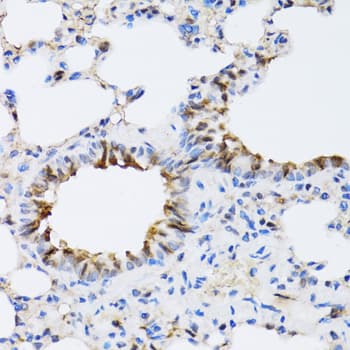 NAA10 / ARD1A Antibody