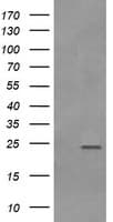 RAB21 Antibody (clone OTI6F11)