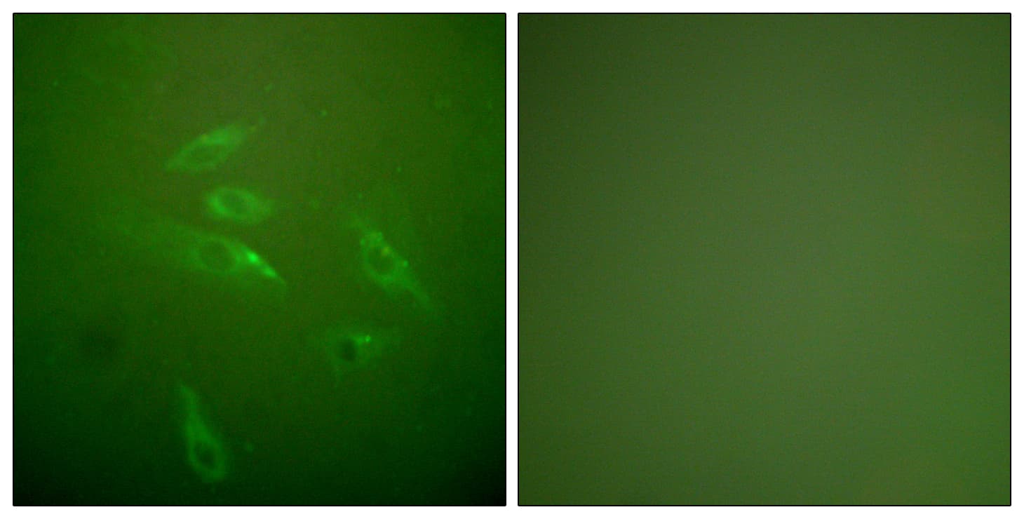 Polyclonal Rabbit anti-Human Collagen III Antibody (aa81-130, IHC, IF)