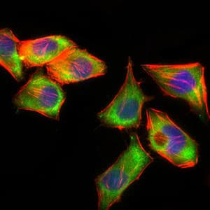 IHC-plus™ PSAP / Prosaposin Antibody (clone 4D5F4)