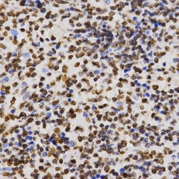 Histone H3 Antibody (Dimethyl-Lys27)