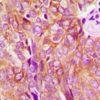 IHC-plus™ EGFR Antibody (Internal)