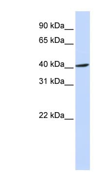 Polyclonal Rabbit anti-Human FBXO28 Antibody (C-Terminus, WB)