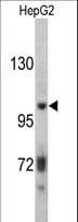 ITIH2 Antibody (aa858-886)