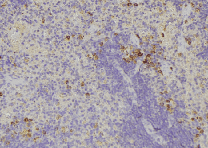 IL32 Antibody