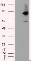 IHC-plus™ RIP1 / RALBP1 Antibody (clone 1H9)
