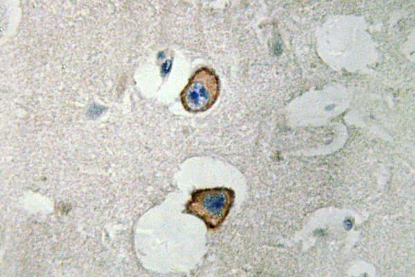 GRIN2D / NMDAR2D / NR2D Antibody (aa644-693)