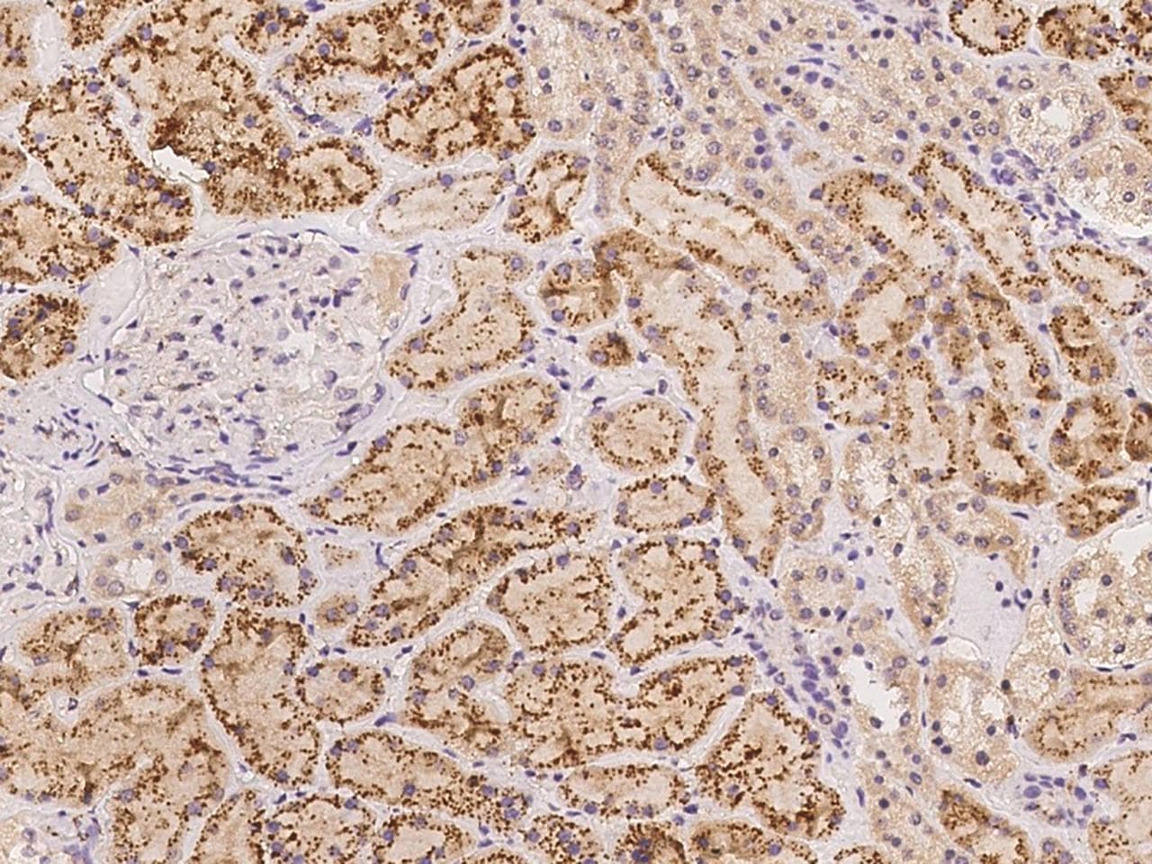 HMCN1 Antibody
