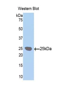 LOXL1 Antibody (aa369-574, PE)