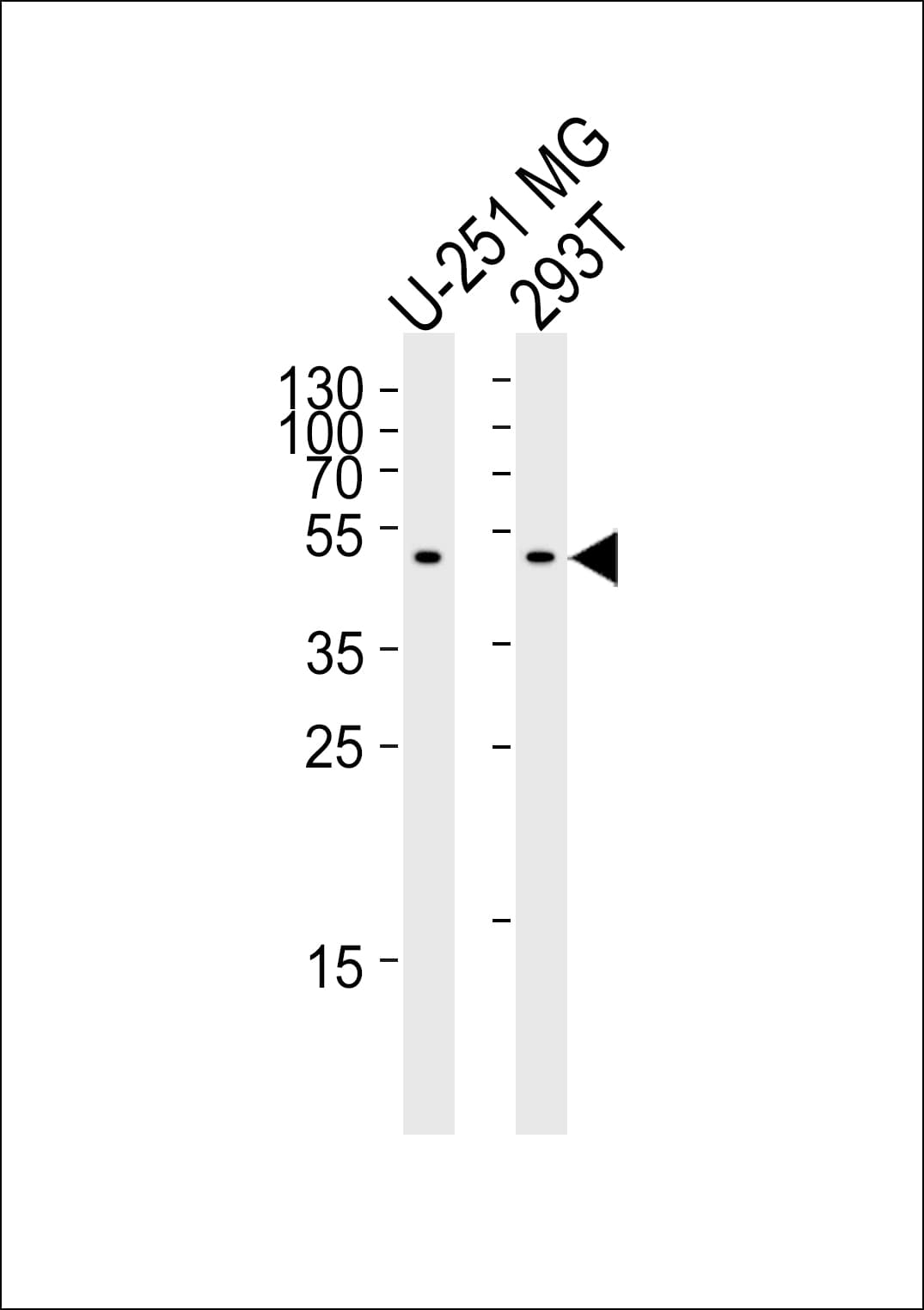 IHC-plus™ Polyclonal Rabbit anti-Human CPM / Carboxypeptidase M Antibody (aa212-241, IHC, WB)