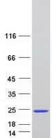 Human SCOC Protein (Recombinant Myc-DDK (Flag))