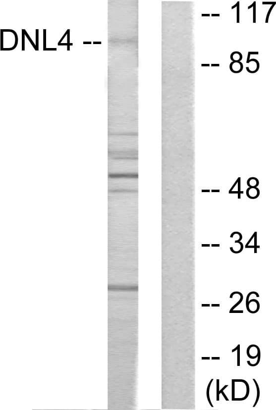 LIG4 / DNA Ligase IV Antibody (aa591-640)