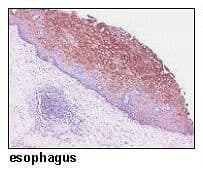 Polyclonal Rabbit anti-Human SLC38A2 / SNAT2 Antibody (IHC, WB)