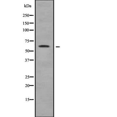 TRIM35 Antibody