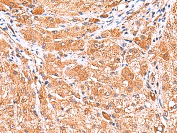 PHKG2 Antibody