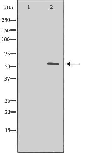 MYOC / Myocilin Antibody