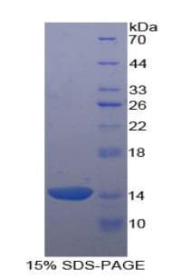 Human AGRP Protein (Recombinant His)