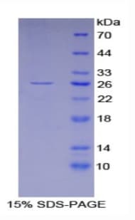 Mouse GSTA4 Protein (Recombinant His)