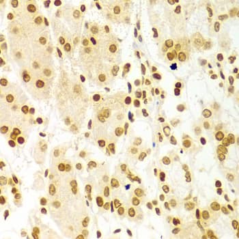 Polyclonal Rabbit anti-Human DKC1 / Dyskerin Antibody (IHC, IF, WB)