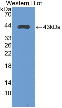 GAD1 / GAD67 Antibody (aa1-97, APC)