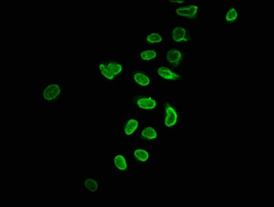 HIST1H2BN Antibody