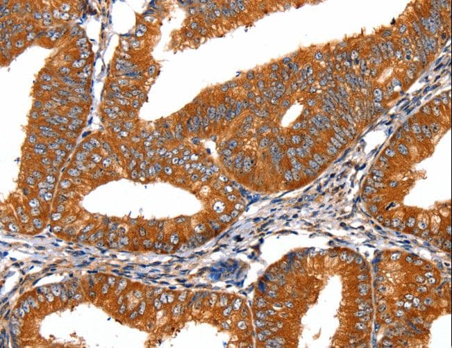 FGFR1 / FGF Receptor 1 Antibody