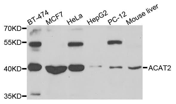 ACAT2 Antibody