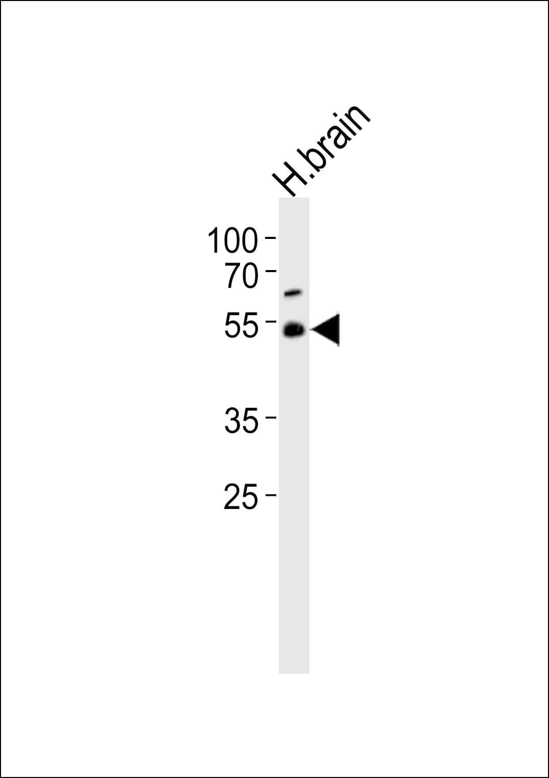 Polyclonal Rabbit anti-Human TRIM43B Antibody (aa222-257, WB)