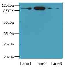 ASAP3 Antibody
