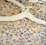 CFB / Complement Factor B Antibody (aa395-422)