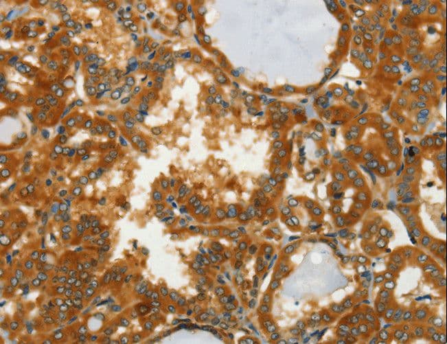 Aspartate Aminotransferase Antibody