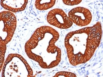 KRT18 / CK18 / Cytokeratin 18 Antibody (clone SPM265, Azide-free, BSA-free)