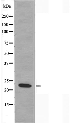 Polyclonal Rabbit anti-Human MRPL20 Antibody (IF, WB)