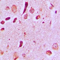 MAPK8IP3 / JIP3 Antibody (Internal)