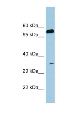 SDS Antibody (aa71-120)
