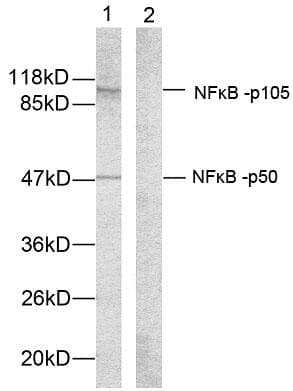 NFKB1 / NF-Kappa-B Antibody (p907)