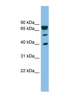Polyclonal Rabbit anti-Human LETMD1 / HCCR1 Antibody (aa271-320, IHC, WB)