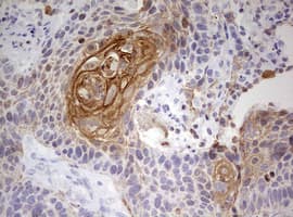 KRT7 / CK7 / Cytokeratin 7 Antibody (clone OTI1C5)