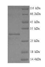 Human LHPP Protein (Recombinant 6His, N-terminus)