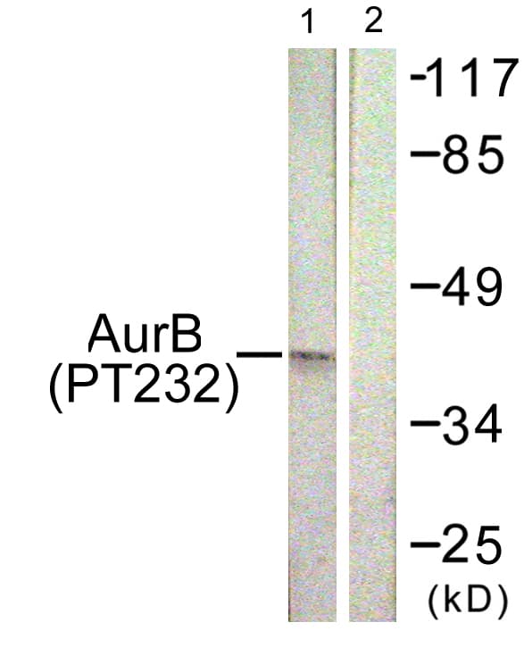 AURKB / Aurora-B Antibody (phospho-Thr232)