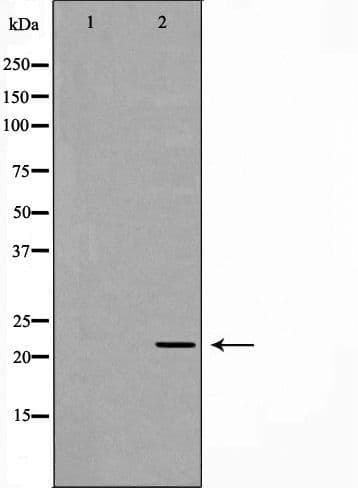 PSMB2 Antibody