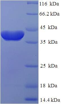 Human RAB2A / RAB2 Protein (Recombinant His-SUMO)
