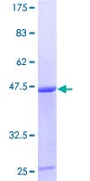 Human CDC42 Protein (Recombinant GST)